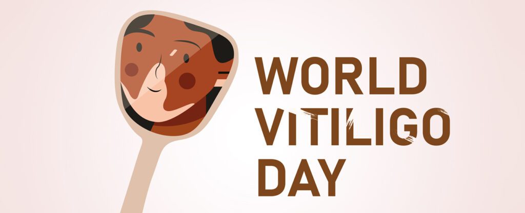 World vitiligo day - 25<sup>th</sup> June VITILIGO VITILIGO