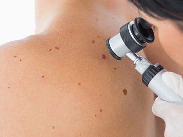 Dermatologist Skin Care Skin Cancer Dubai Treatment Doctor Medical Hair Acne Clinic Laser Specialist Clinics Procedures Doctors Aesthetic Doctors Therapy Treat Diseases Patients Center Nails Skin Disorders Skin Hair United Arab Emirates Skin Diseases Acne Scars