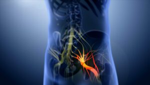 Can Sciatica Cause Poor Circulation Dubai Orthopedic Physiotherapy